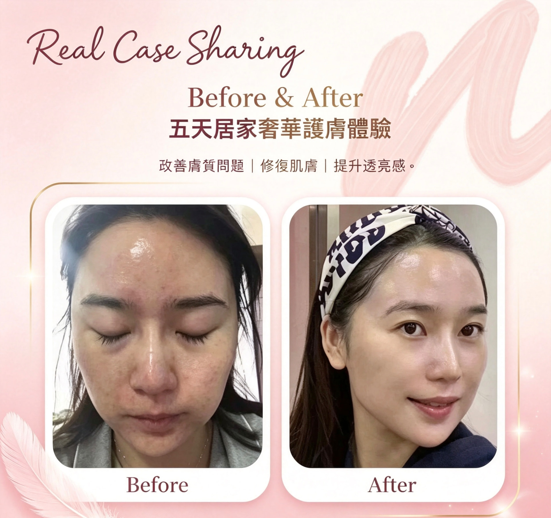 真實案例 Before & After 1