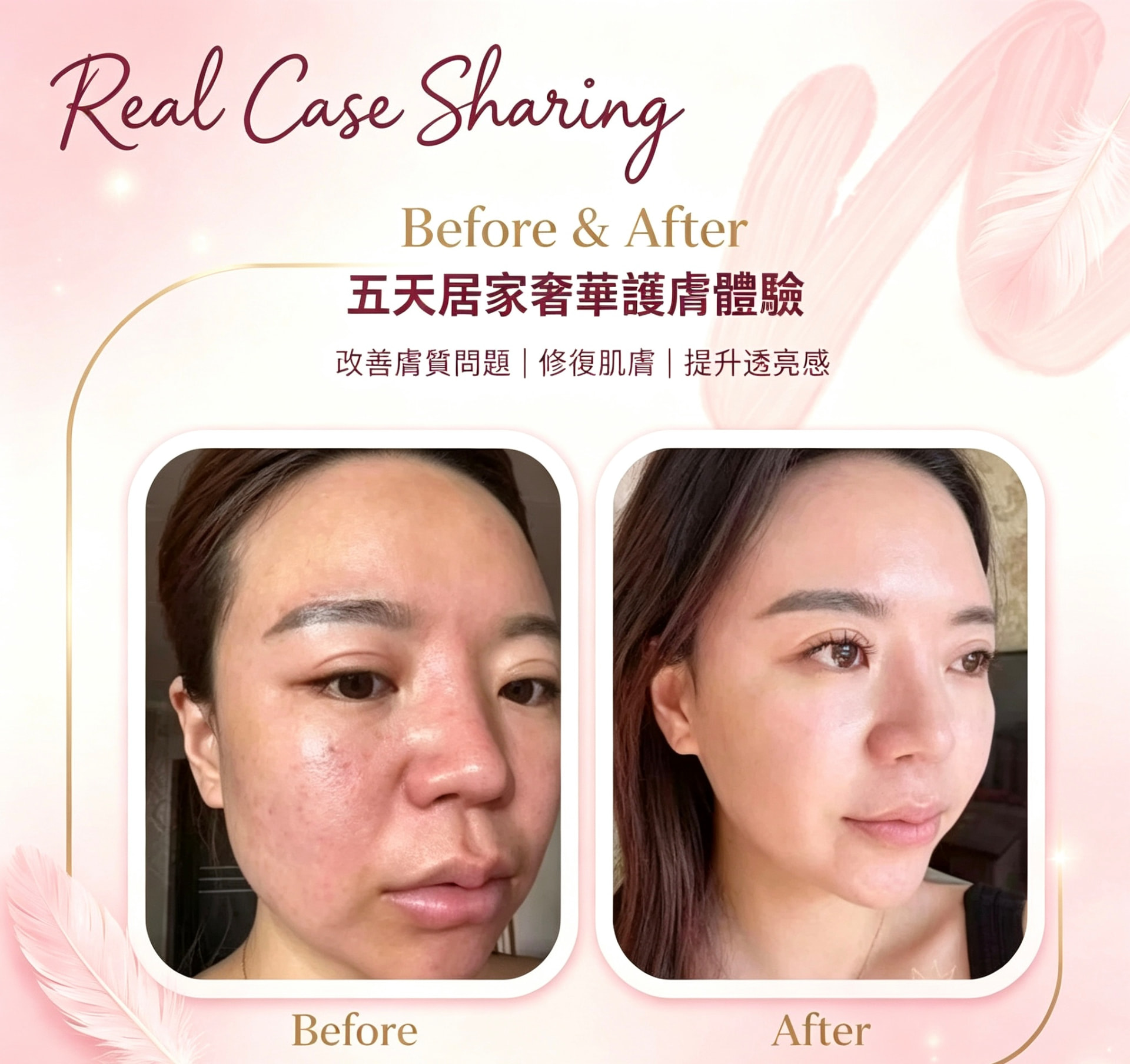 真實案例 Before & After 5