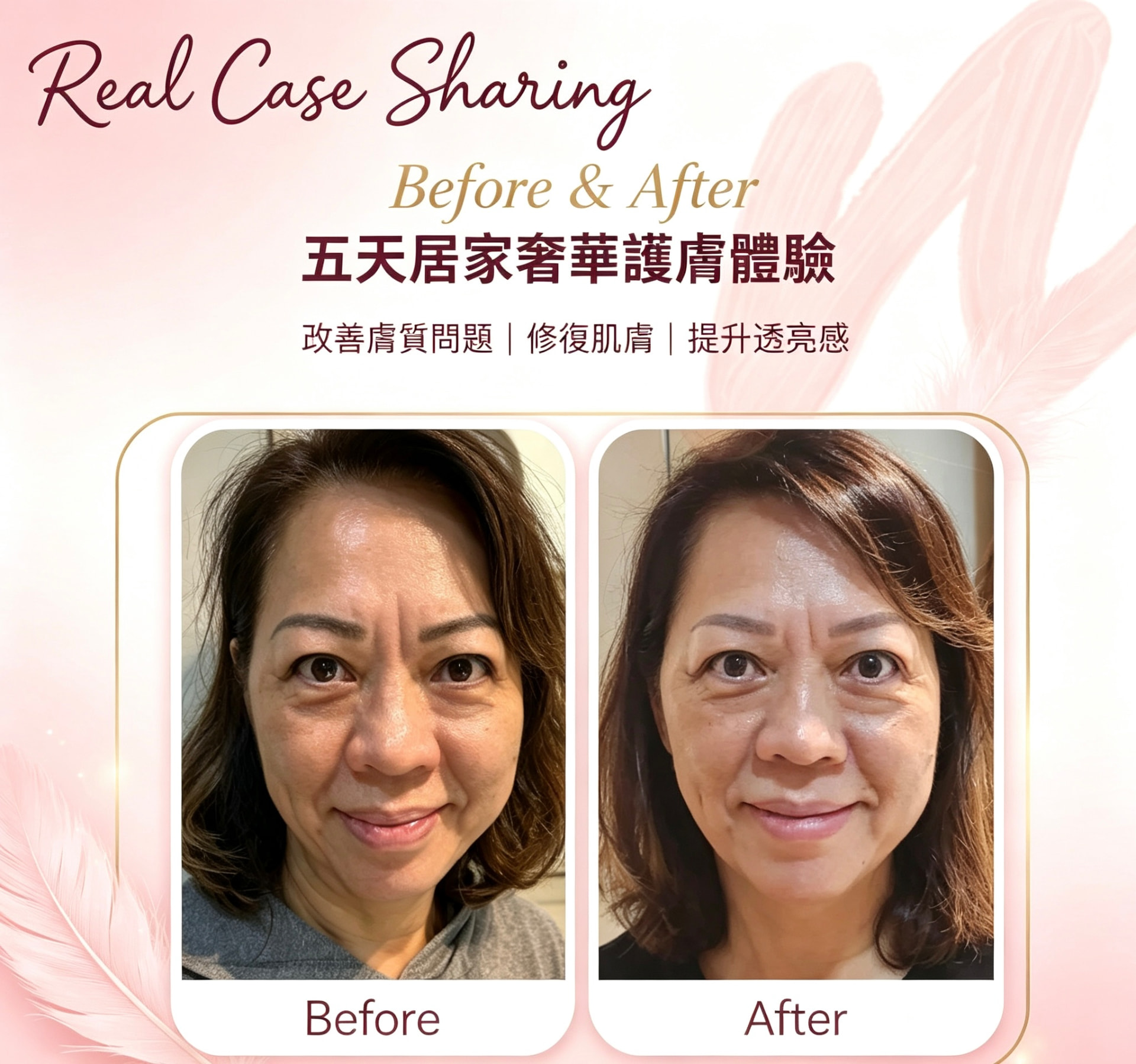 真實案例 Before & After 3