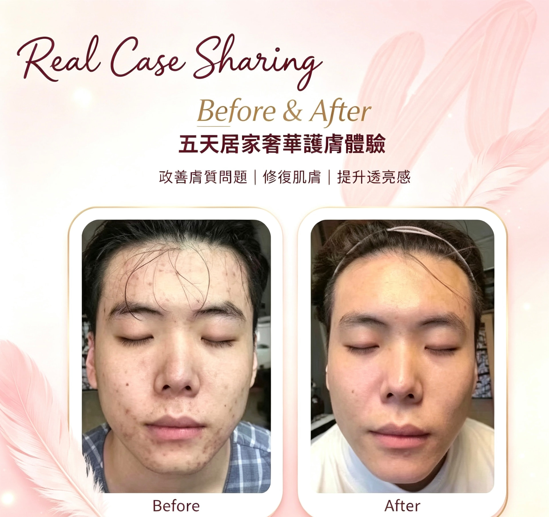 真實案例 Before & After 4