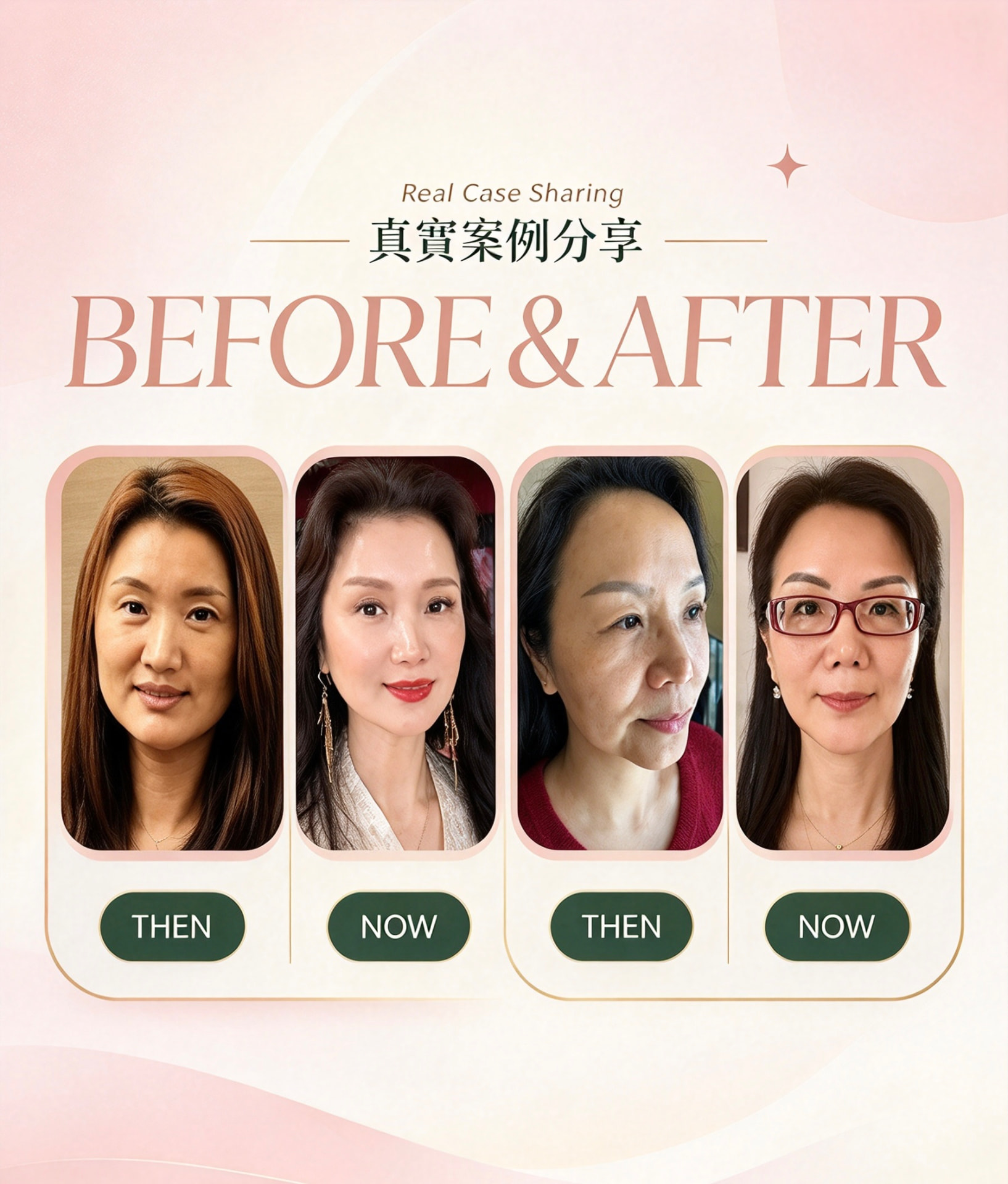 真實案例 Before & After 6