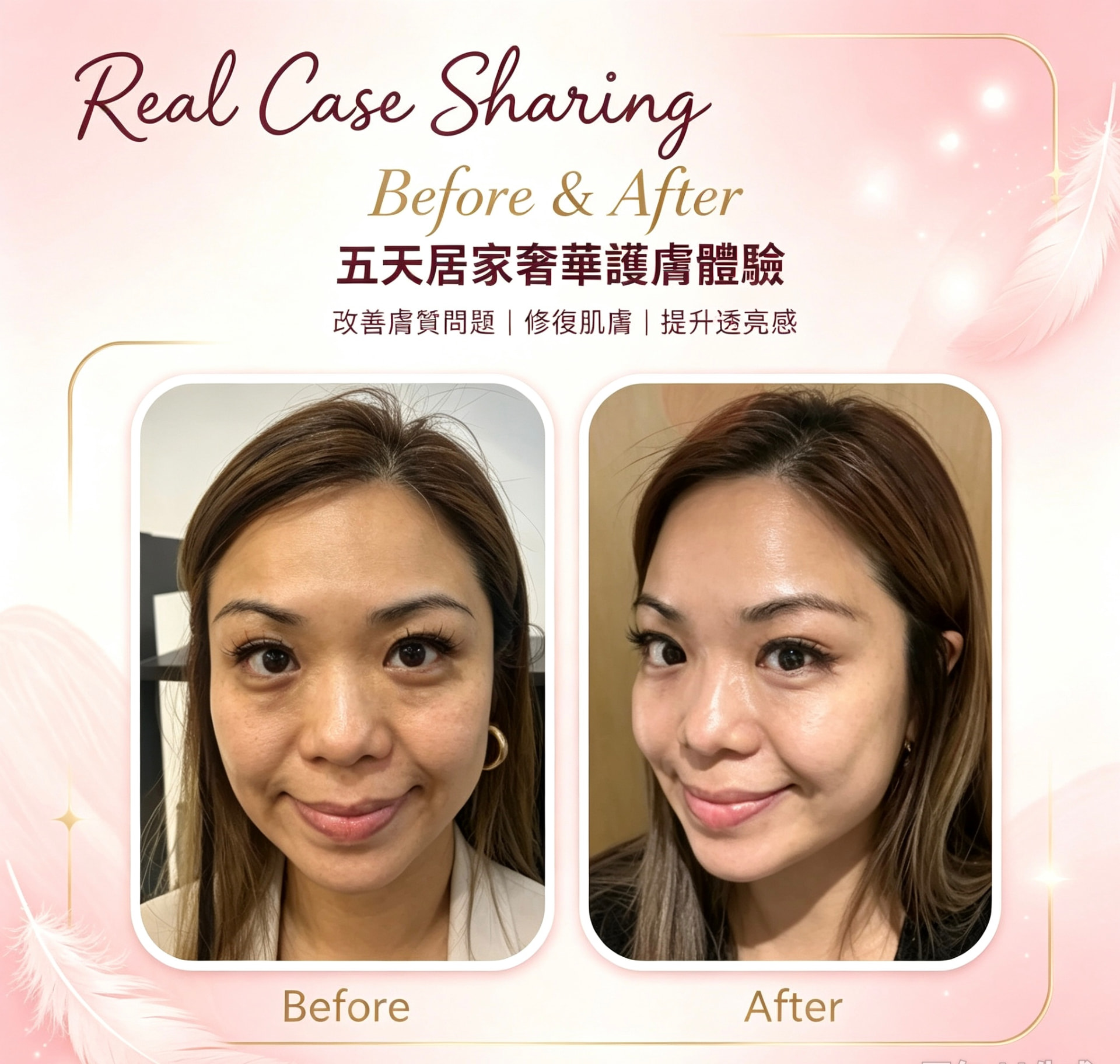 真實案例 Before & After 2